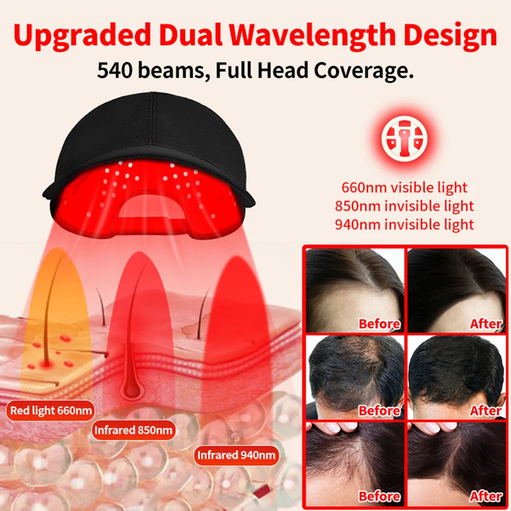 180Pcs Infrared LEDs 660&850&940nm Red Light Therapy Hair Growth Cap for Hair Regrowth Anti Hair Loss Relax Scalp Hair Care Hat